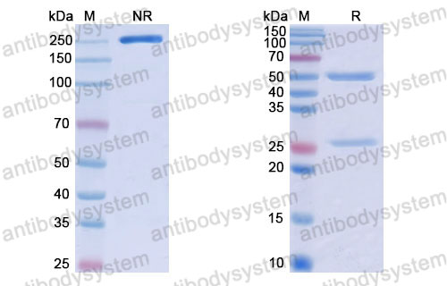Валидация SDS-PAGE - AntibodySystem RHJ92808