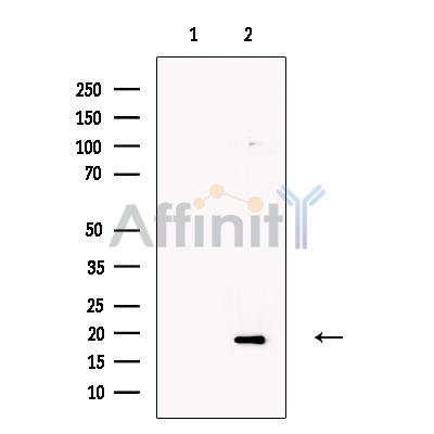 Валидация Affinity DF13678 - 9262