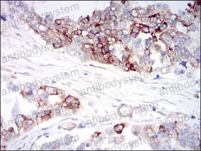 Валидация AntibodySystem RHH25203 (3242)