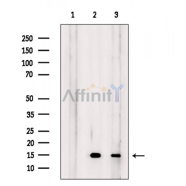 Валидация Affinity AF6636 - 3925
