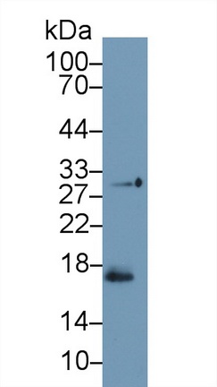 14955