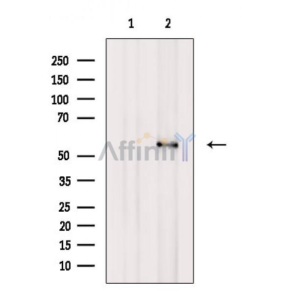 Валидация Affinity AF6599 - 3900