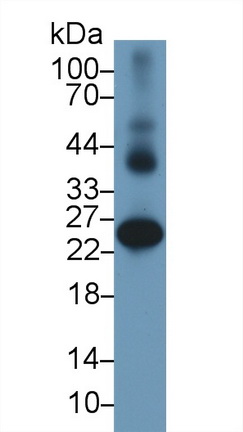12324