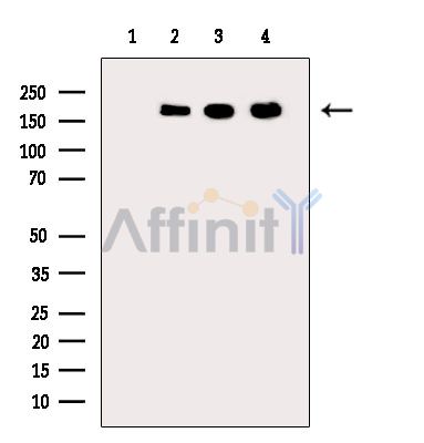 Валидация Affinity DF14254 - 10107