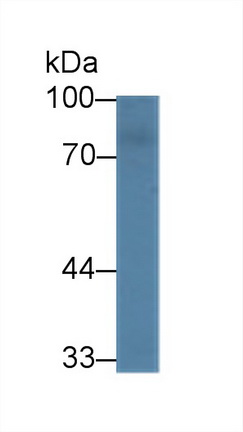 14292