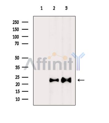 Валидация Affinity DF15419 - 11747