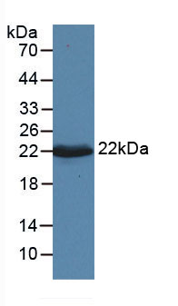 14983