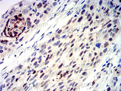 Валидация AntibodySystem RHN81704