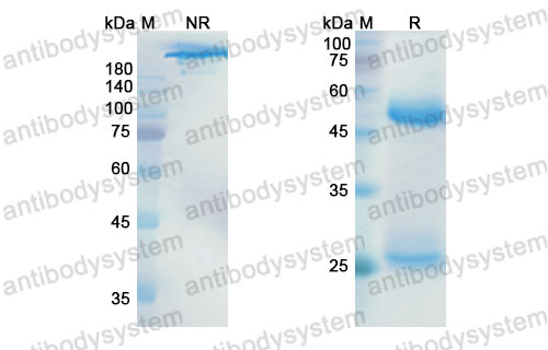 Валидация SDS-PAGE - AntibodySystem DHC29908