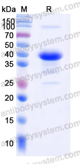 YHJ73302, SDS-PAGE