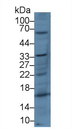 14727