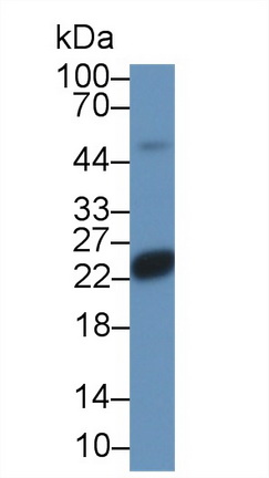 14194