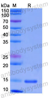 Валидация SDS-PAGE - AntibodySystem RHF92401