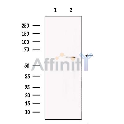 Валидация Affinity DF13573 - 9036