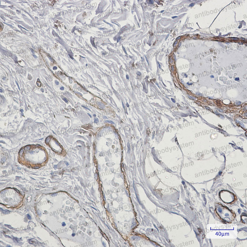 Валидация AntibodySystem RHG05602