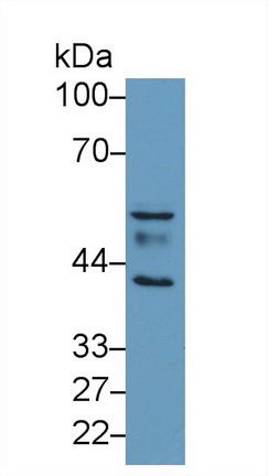 13195