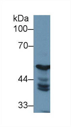 13148