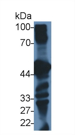 14791