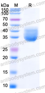 EHJ38602, SDS-PAGE