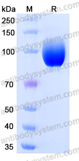 AHJ31001, SDS-PAGE