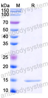 Валидация SDS-PAGE - AntibodySystem RVV02821