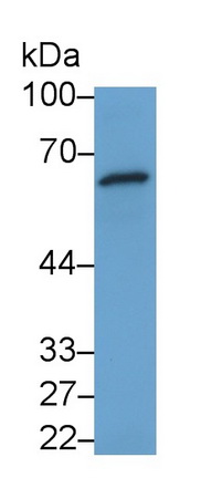 51861
