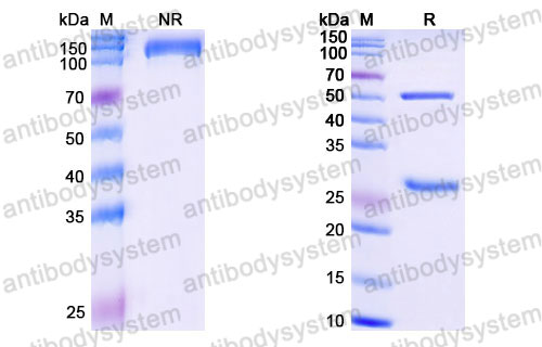 Валидация SDS-PAGE - AntibodySystem DHC82406