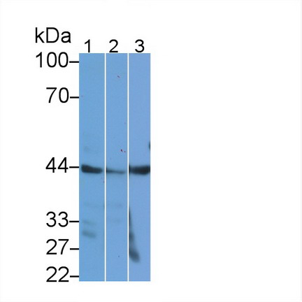 18561