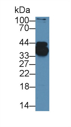 12607