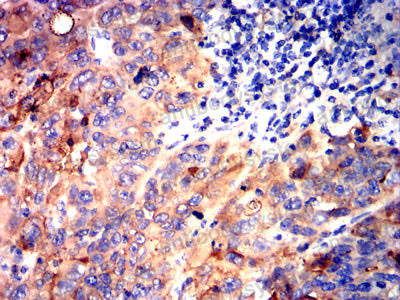 Валидация AntibodySystem RHK08803 (3617)