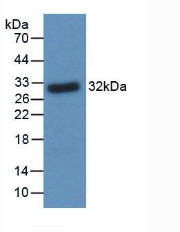 61415