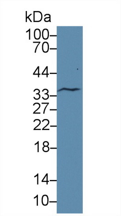 17690