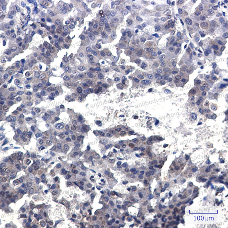 Валидация AntibodySystem RHH86801