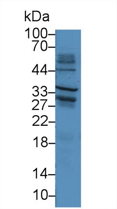 12926