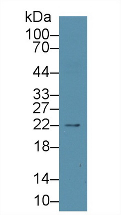 61992