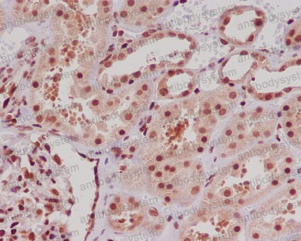 Валидация AntibodySystem RHC87802 (1145)