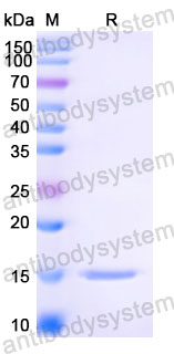 Валидация SDS-PAGE - AntibodySystem RVV03101