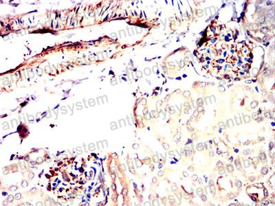 Валидация AntibodySystem RHN05103 (3785)