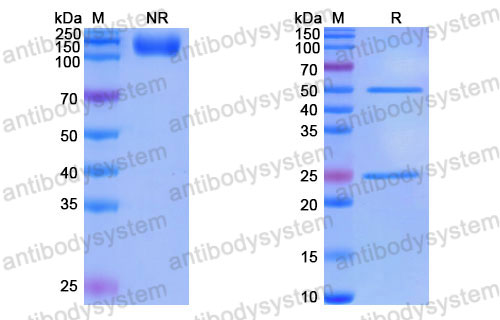 Валидация SDS-PAGE - AntibodySystem DHD68913