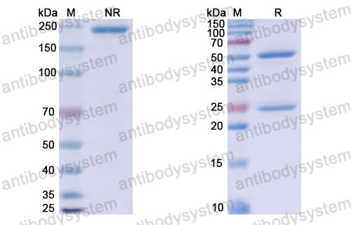 Валидация SDS-PAGE - AntibodySystem RHJ93101