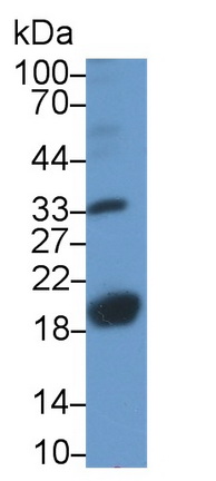 21818