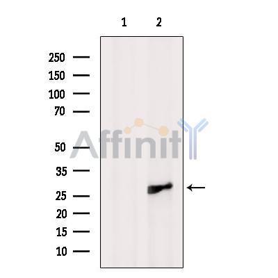 Валидация Affinity AF9198 - 5025