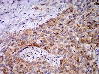 Валидация AntibodySystem RHA07502 (26)