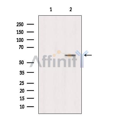 Валидация Affinity DF4368 - 15835