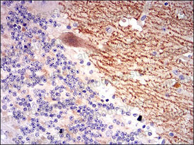 Валидация AntibodySystem RHB34504