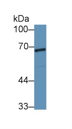 28379