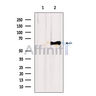 Валидация Affinity DF6308 - 17627