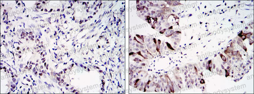 Валидация AntibodySystem RHD05703