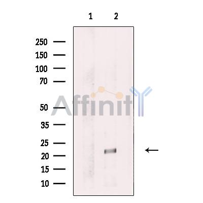 Валидация Affinity DF13613 - 9123