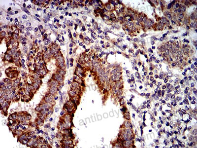 Валидация AntibodySystem RHH16402
